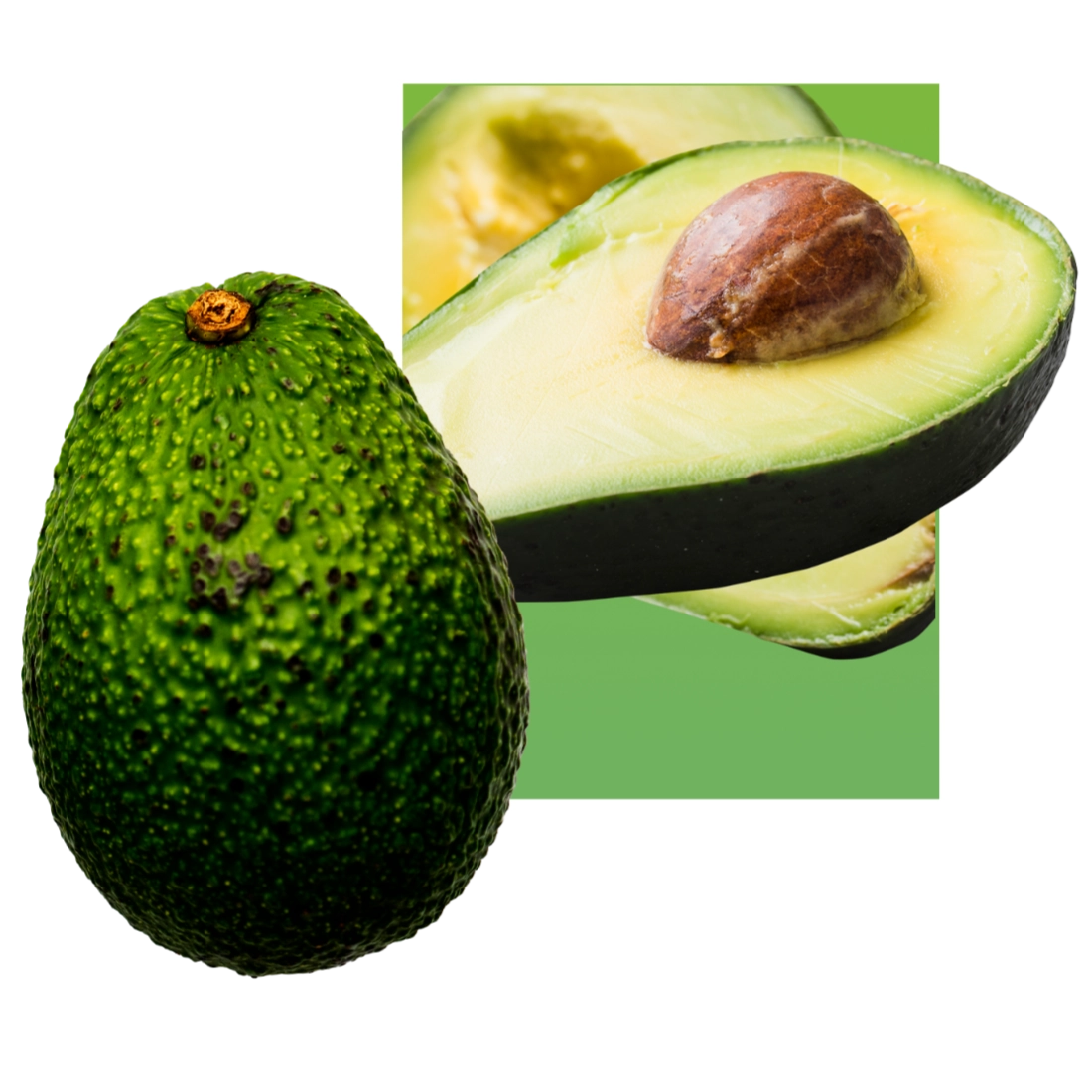 Avocado Value Pack